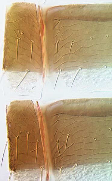 File:Thrips alliorum pleurotergites.jpg