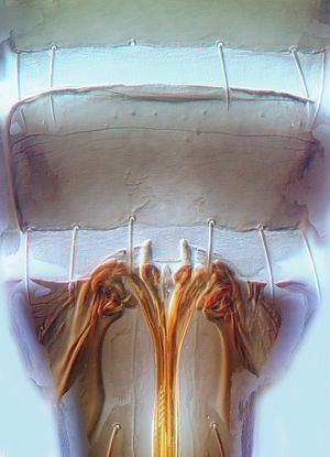 Megalurothrips typicus VII.jpg