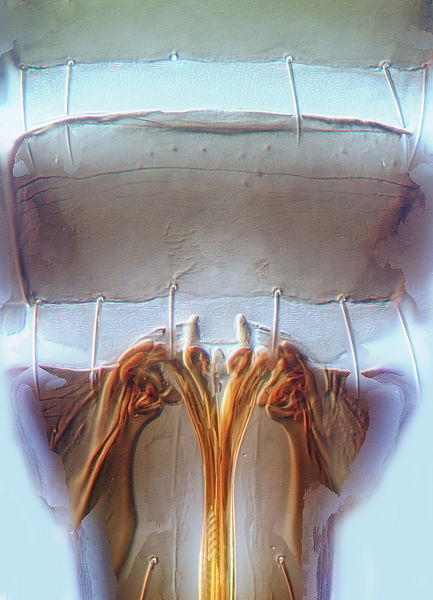 File:Megalurothrips typicus VII.jpg