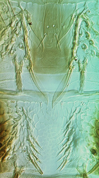 File:Habrothrips curiosus tergites VII-VIII.jpg