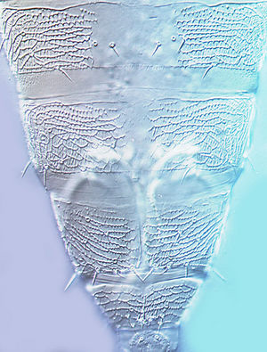 Asprothrips navsariensisTergites.jpg