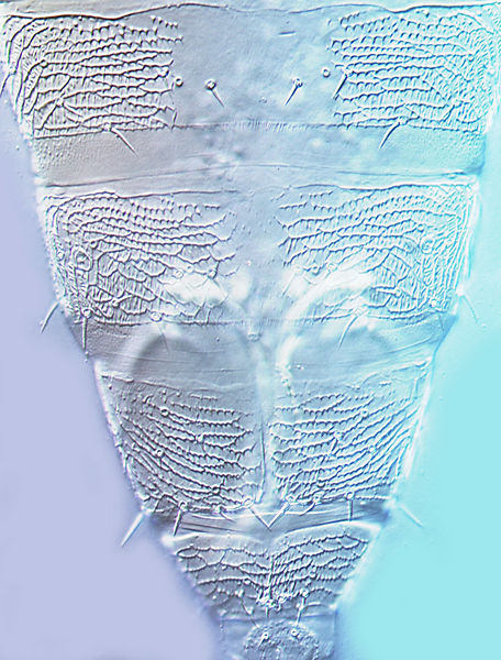 File:Asprothrips navsariensisTergites.jpg