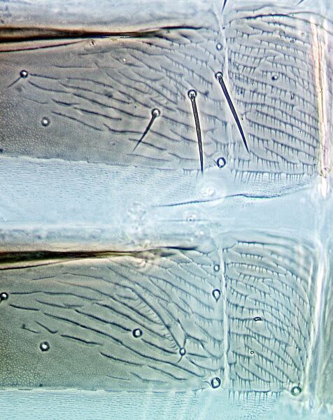 File:Thrips tabaci pleurotergites V-VI.jpg
