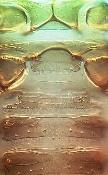 File:Uzelothrips sternites.jpg